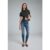 Stradivarius D09 Skinny-Jeans mit sehr hohem Bund  MITTELBLAUER DENIM-WASHED-LOOK 42